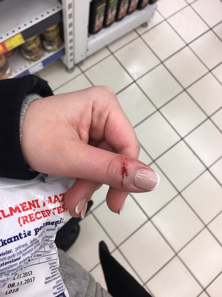 Нет ногтя на пальце ноги