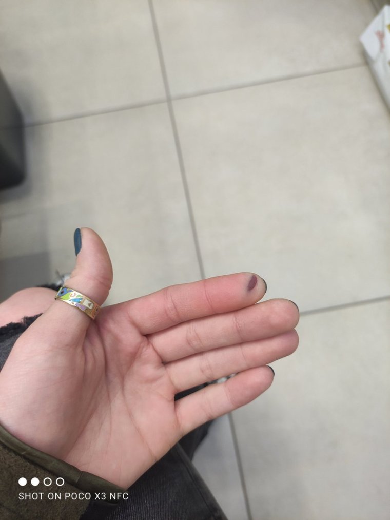 Прищемила палец дверью машины