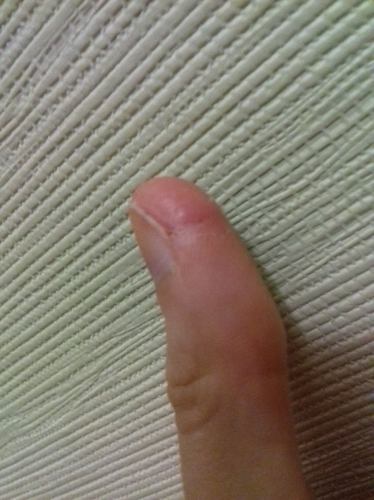 Прищемила палец дверью от машины