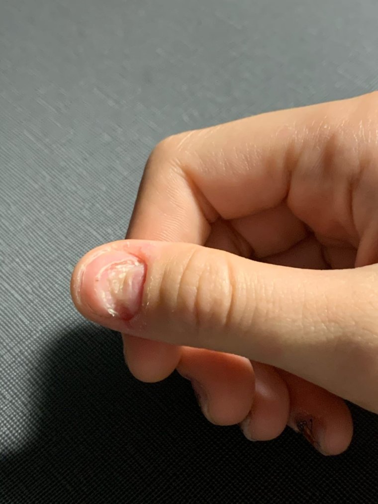 Зажала палец в двери машины