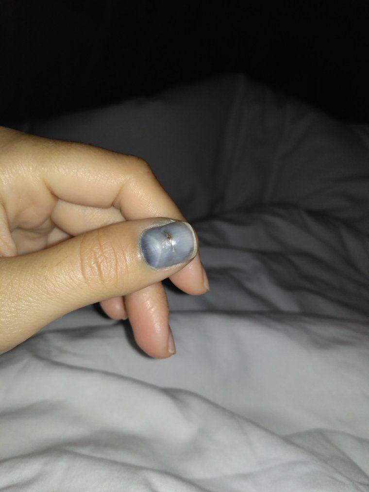 Пальцы прибило дверью машины