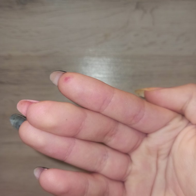 Прищемила палец дверью машины