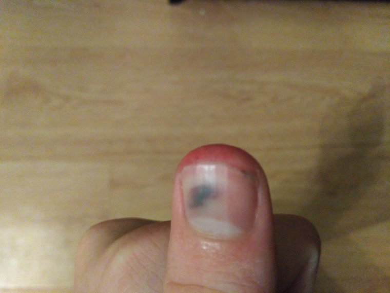 Точки на подушечках пальцев