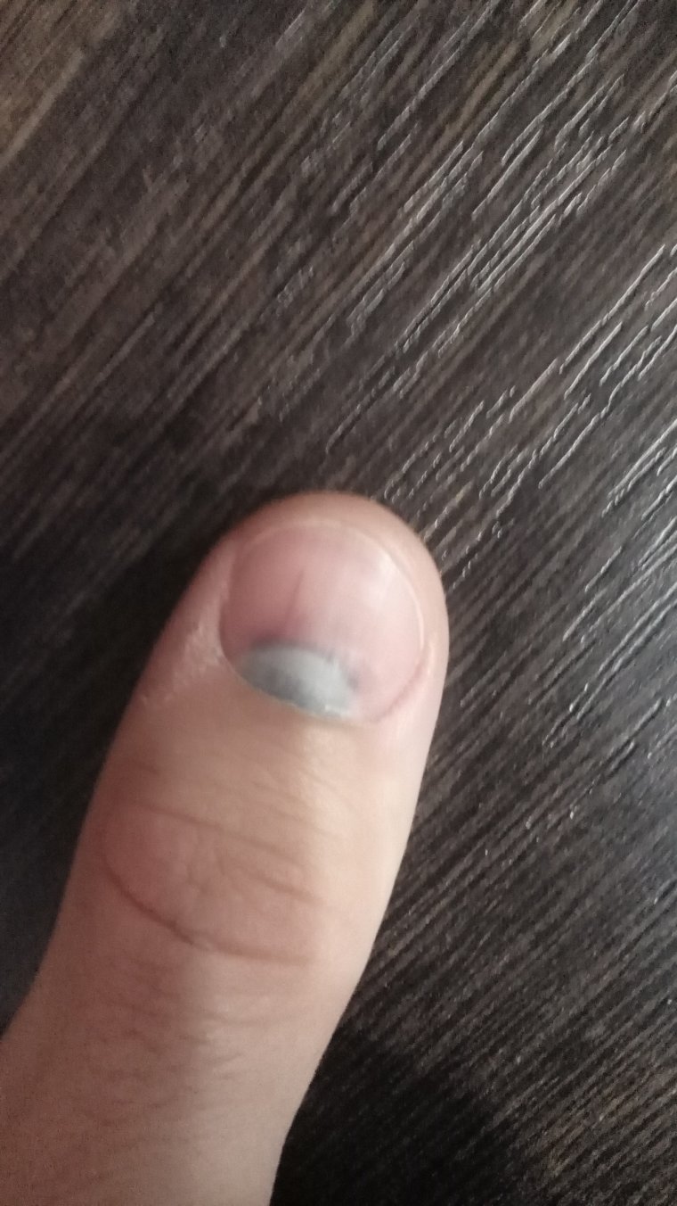 Прищемила палец дверью от машины