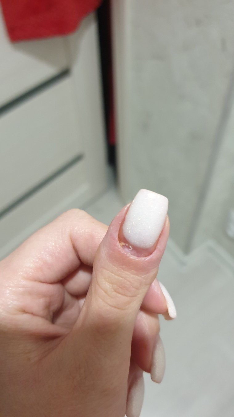 Большой палец закрыла в двери очень болит