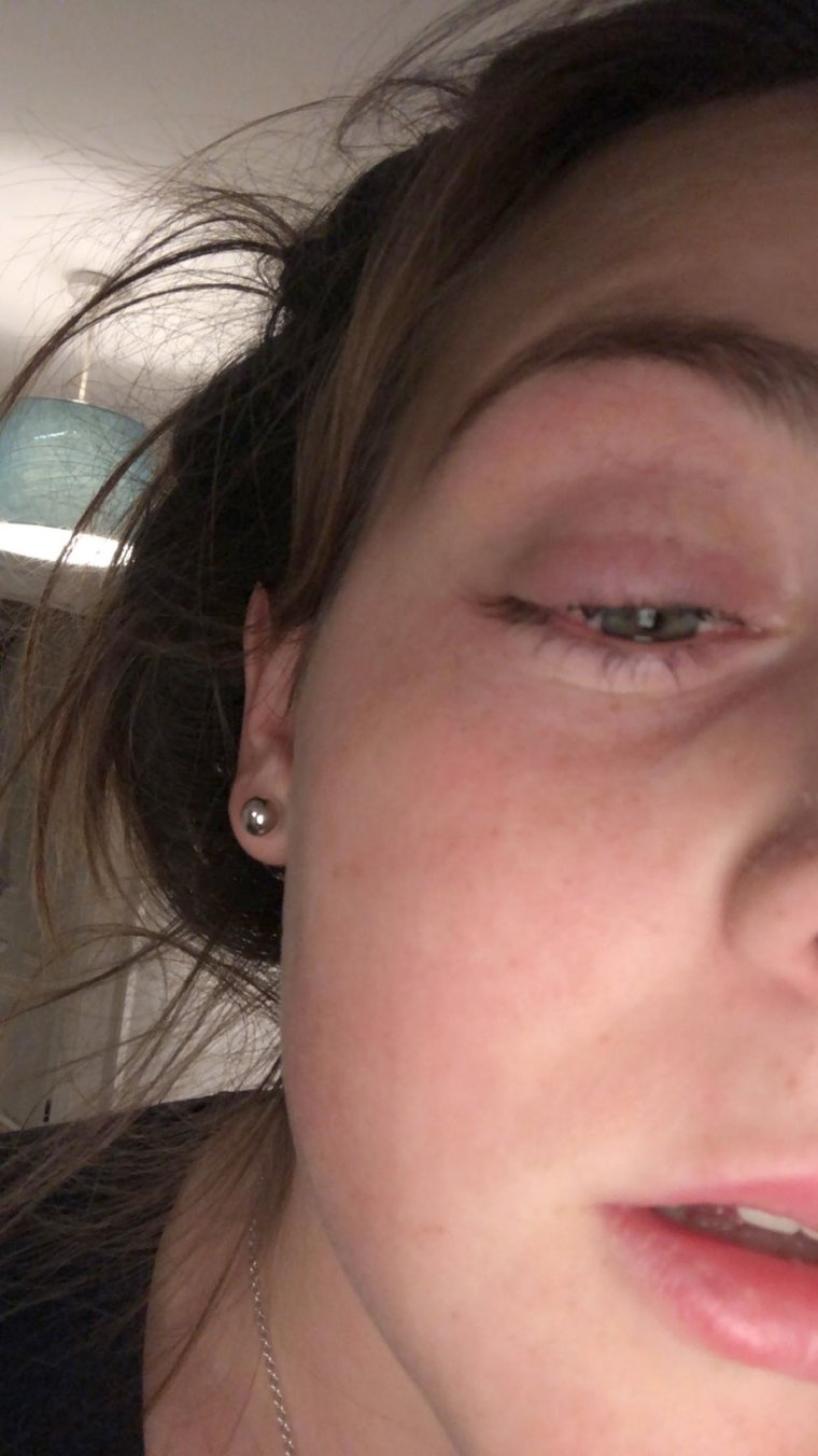 Девочка без ресниц