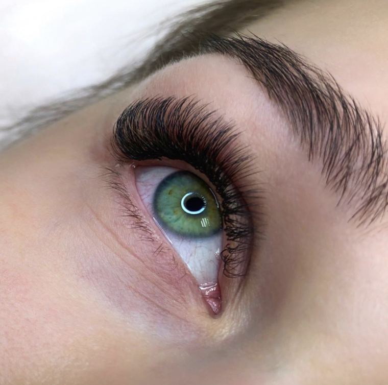 Последствия нарощенных ресниц