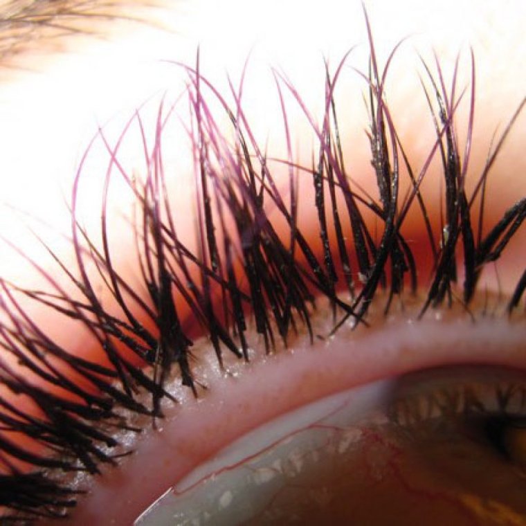 Неудачнонаращенные ресницы