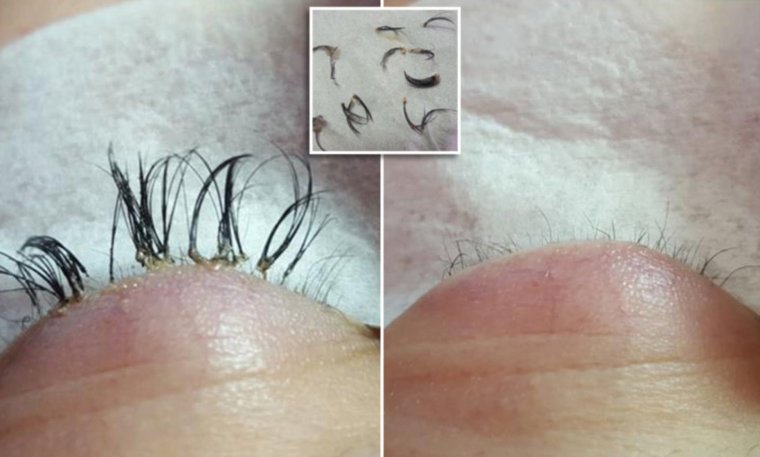 Неудачная завивка ресниц