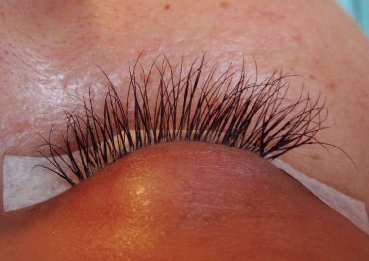 Неправильное наращивание