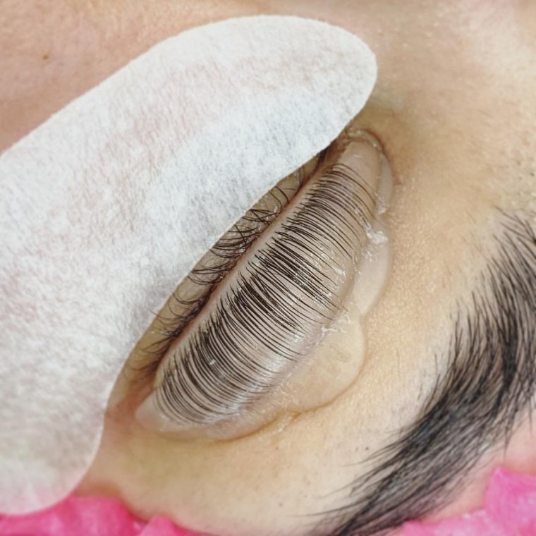 Неудачное наращивание ресниц