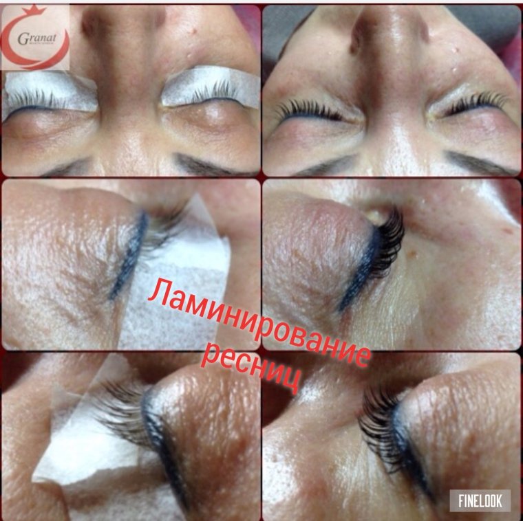 Ресницы после наращивания