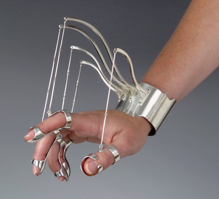 Анекдот про кольцо на пальце