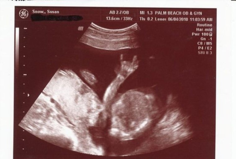 Прикольные УЗИ ребенка