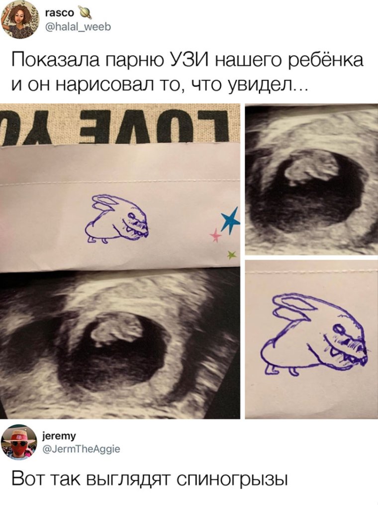 Кровать для УЗИ