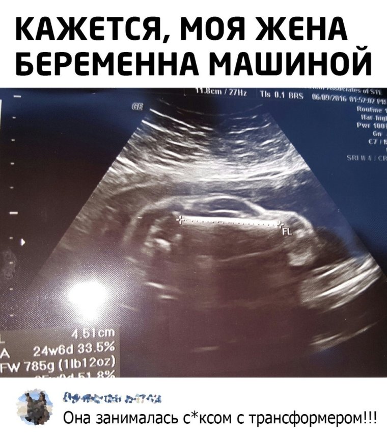 Мемы про УЗИ