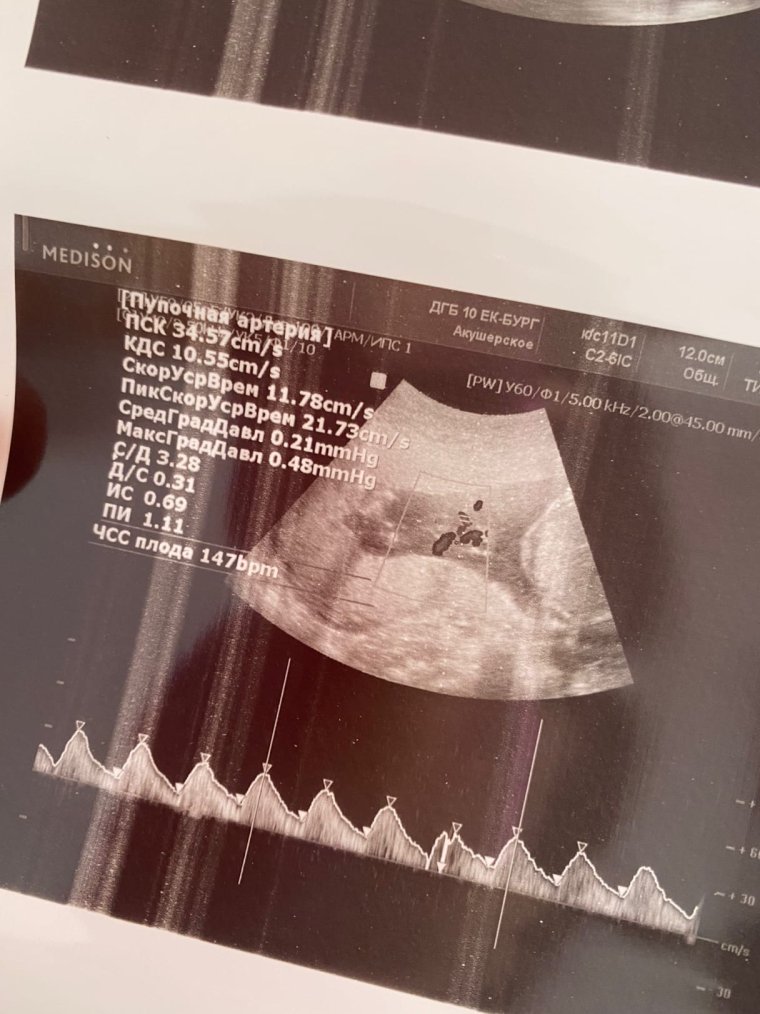 УЗИ беременности кошки