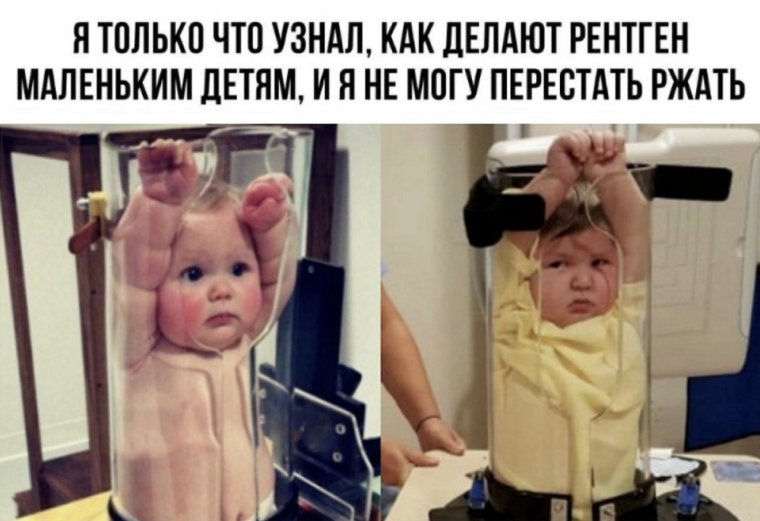 Удивительные снимки УЗИ