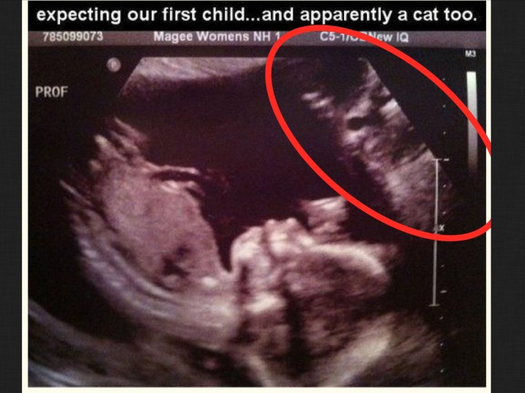 Шутки про УЗИ