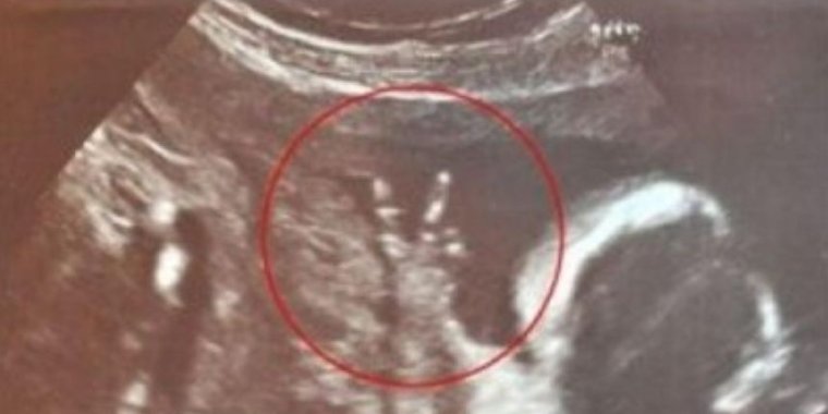 Мы ждем ребенка и кота