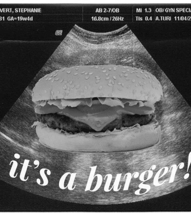 Смешные УЗИ