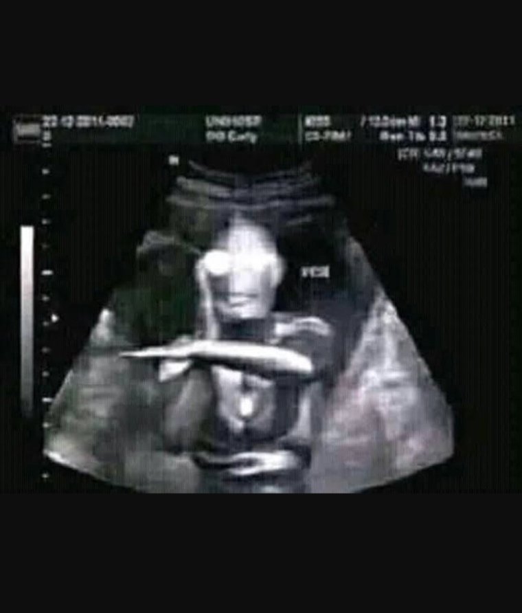 Фото УЗИ прикол