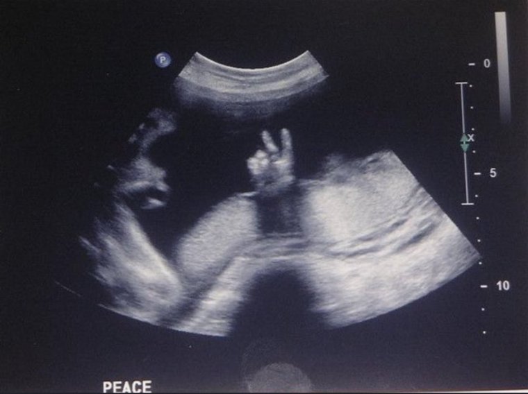 Рентген маленьким детям