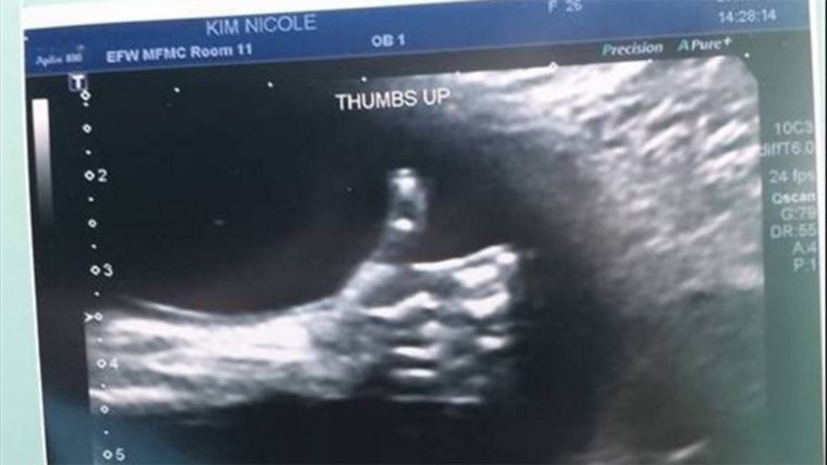 Рисунки на животе у беременных фото