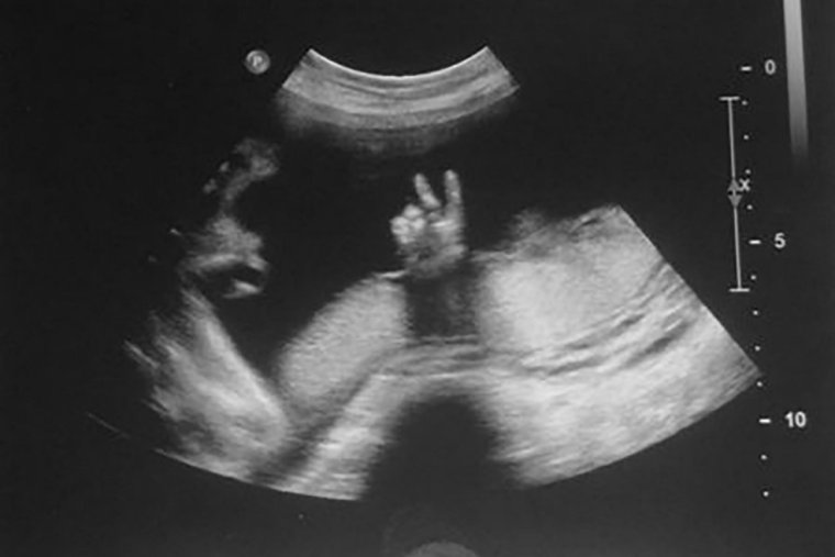 Изображение УЗИ ребенка