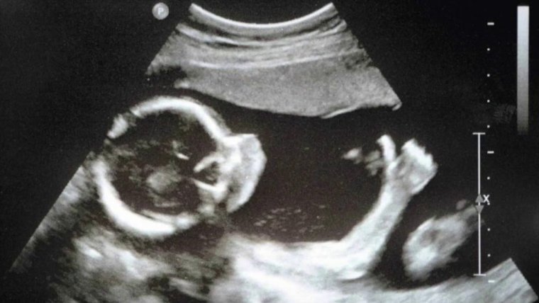 Изображение УЗИ ребенка