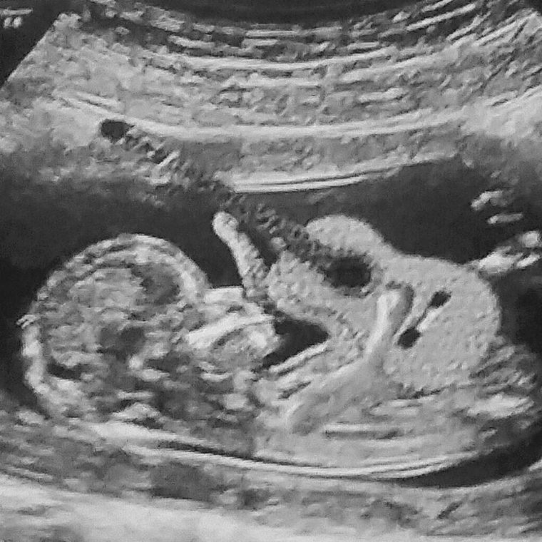 Школьник со стволом