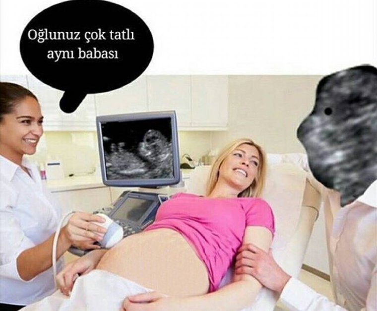 УЗИ приколы