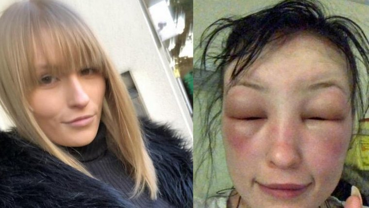 Сожженные волосы