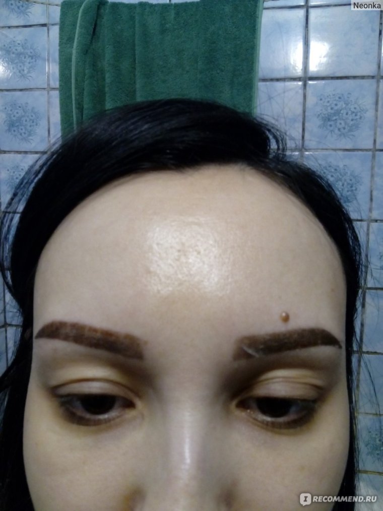 Неудачный татуаж бровей Анафаз