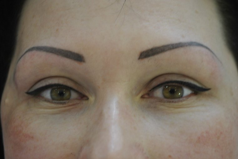 Прямые брови неудачный татуаж