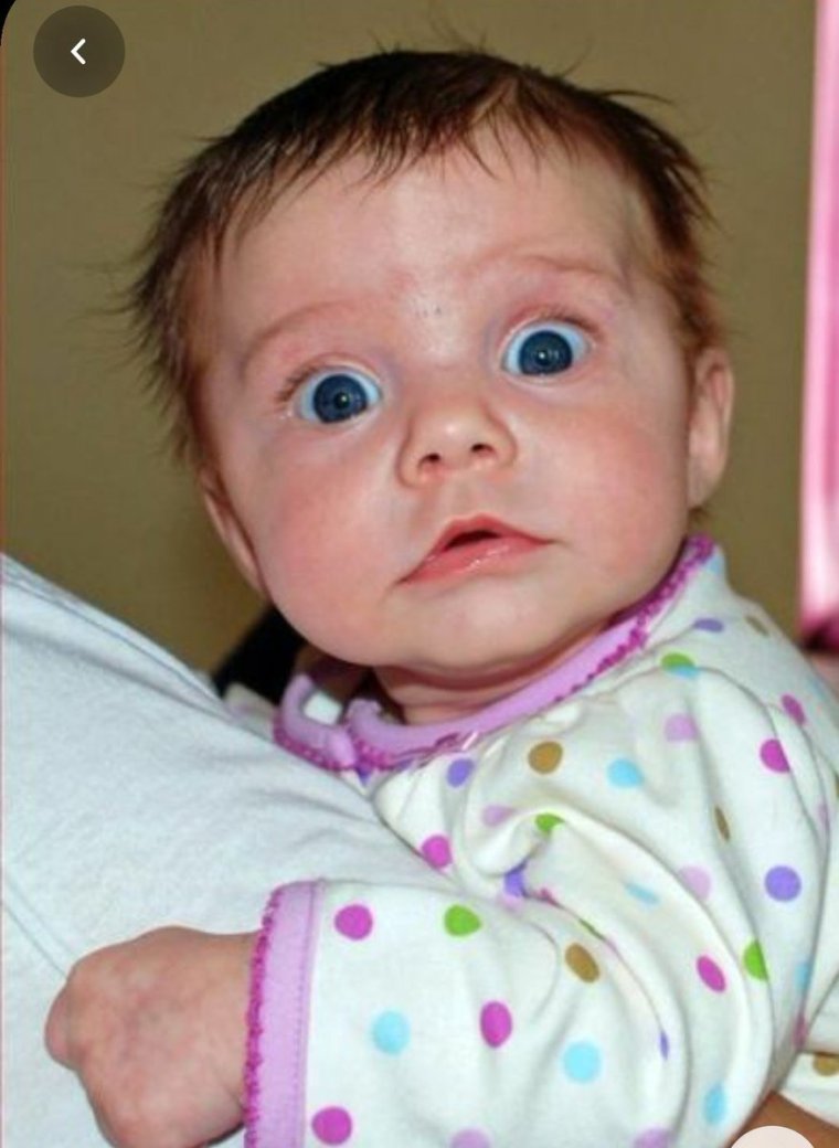 Новорожденный с недовольным лицом