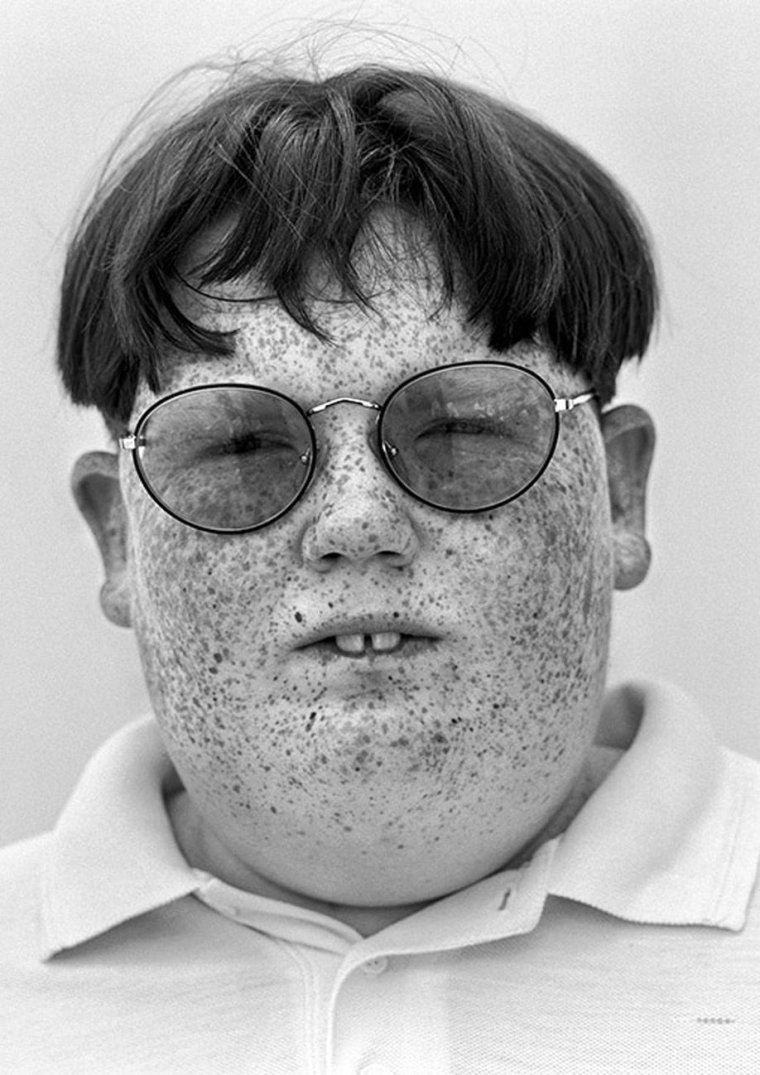 Очки с толстыми линзами