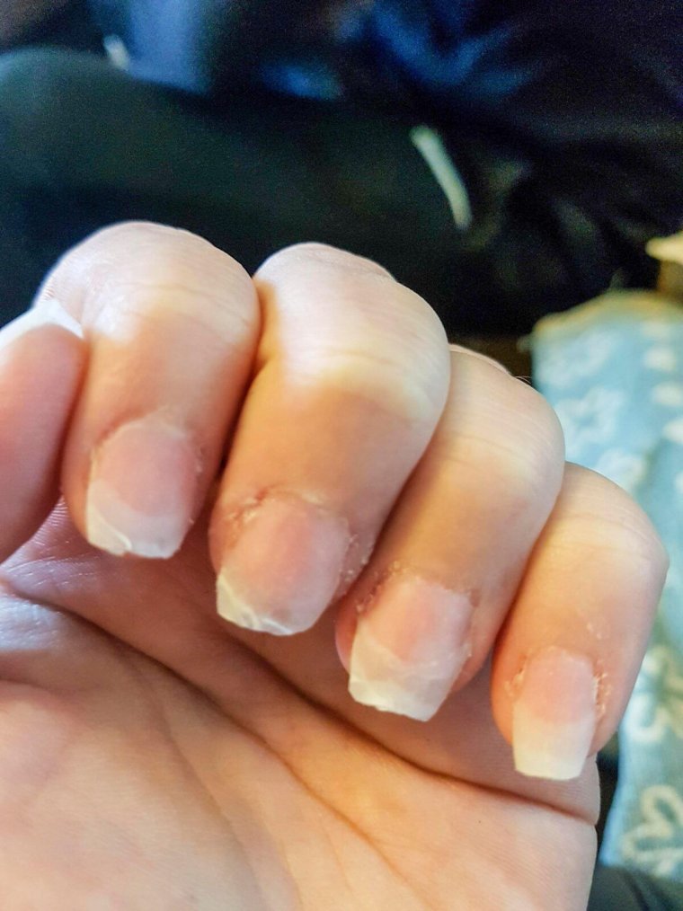 Плохой маникюр