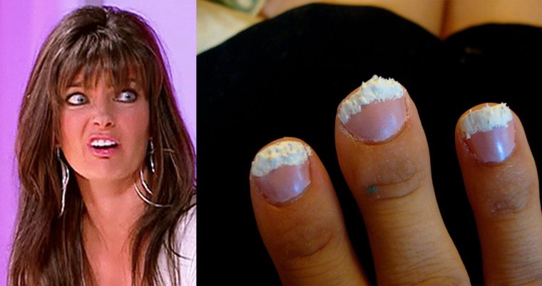 Неудачный маникюр