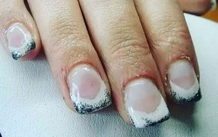 Неудачный маникюр