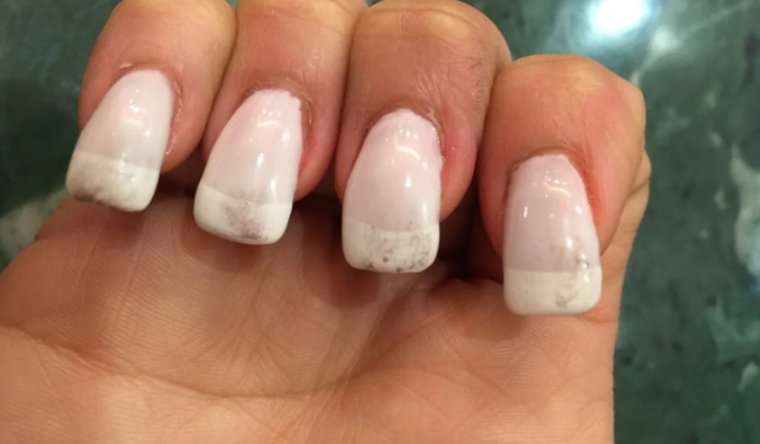 Неудачный маникюр на руках