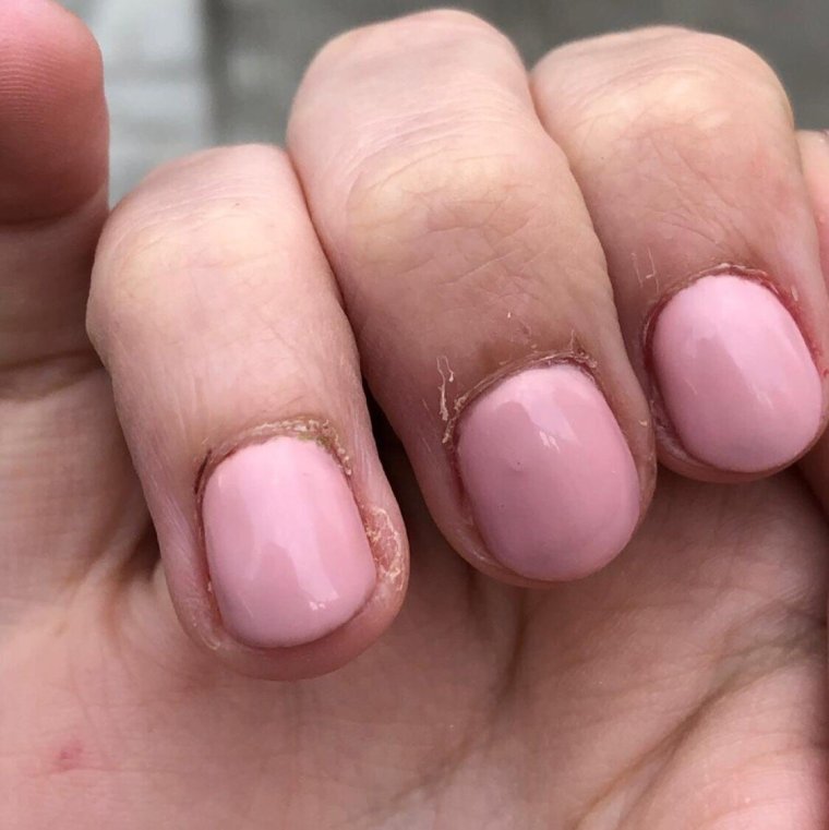 Неудачный маникюр гель лаком