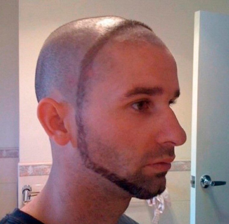 Причёски мужские с лысиной