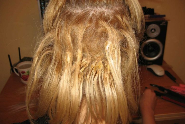 Неудачное наращивание волос