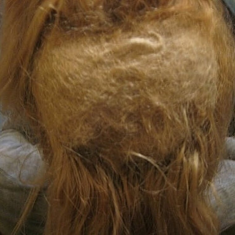 Последствия наращивания волос