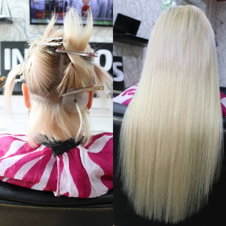 Микронаращивание канекалоном