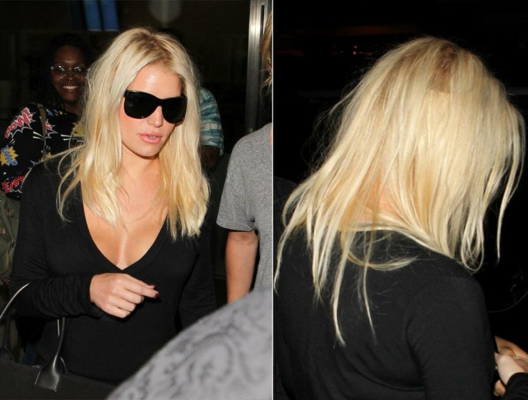 Последствия наращивания волос