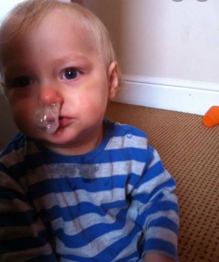 Слюнявый дог