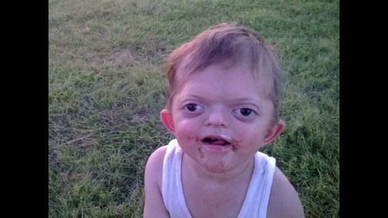 Тупой Патрик