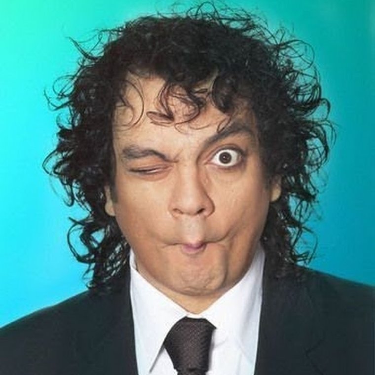 Филипп Киркоров неудачные фото